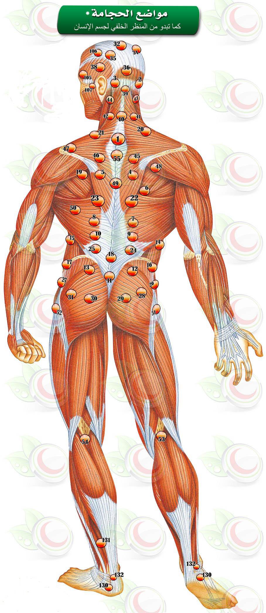 علاج الابهر بالحجامة